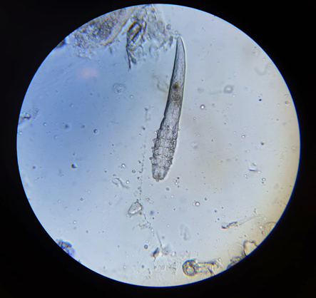 Demodex mijt