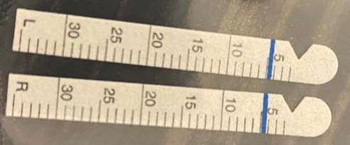 Schirmer tear test